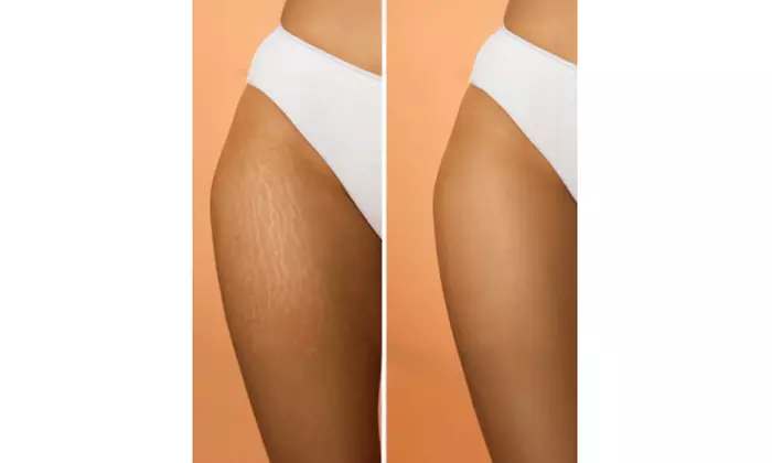 Up to 73% Off on Permanent Makeup at The Camo Clinic