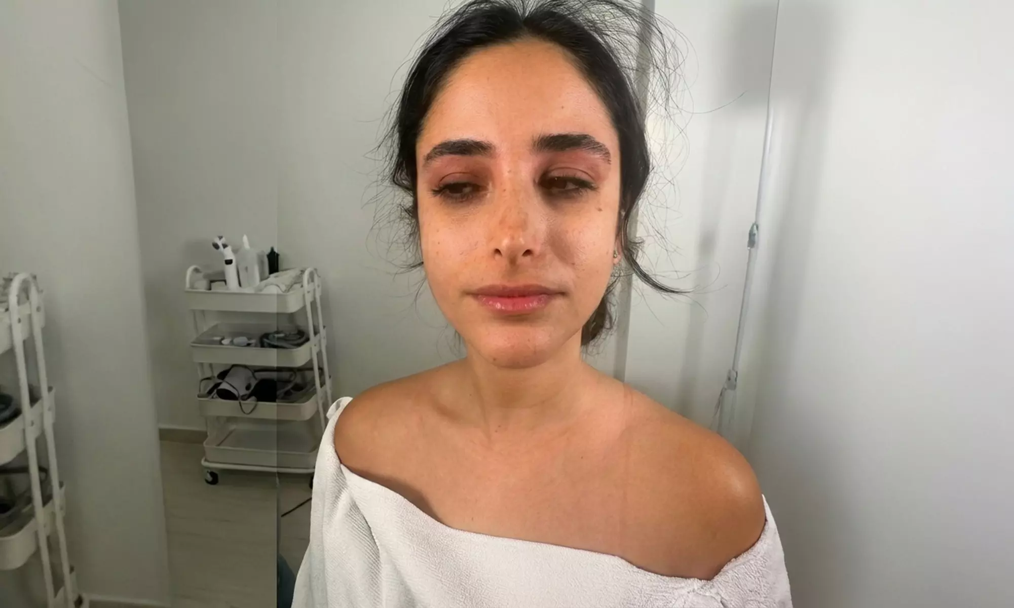 Enhance Your Look with RF Face and Neck Lifting Treatments at The Glo Skin Tight Laser Club - Up to 60% Off - Primary Image