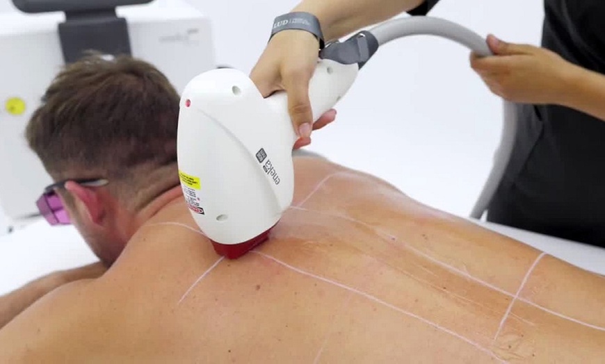 Image 8: Hasta 7 sesiones de depilación láser unisex 