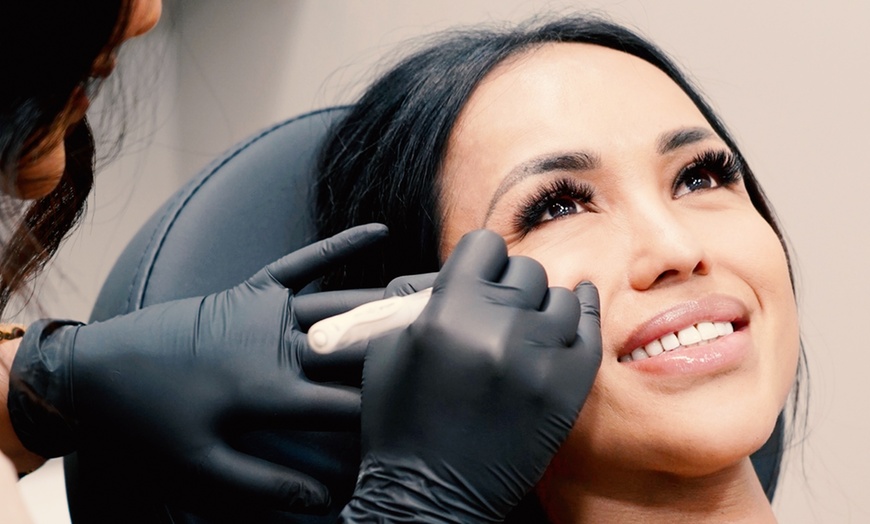 Image 4: Skin Needling, LED Therapy, Face Mask, Consultation, & More 