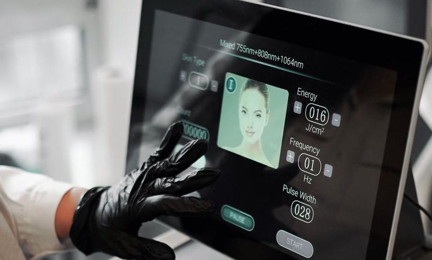 Image 3: 3 oder 5 Sitzungen Diodenlaser-Haarentfernung für 1 Person