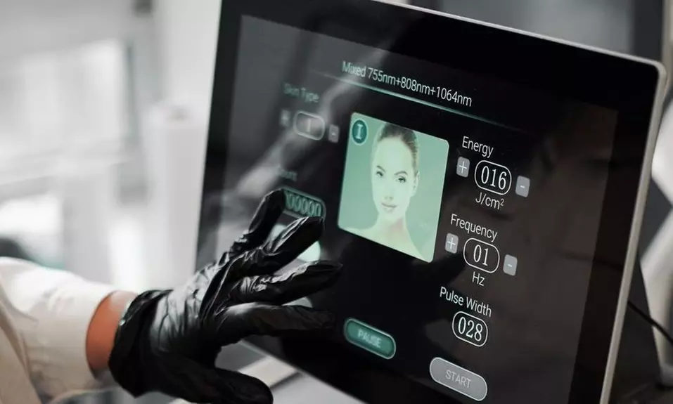 3 oder 5 Sitzungen Diodenlaser-Haarentfernung für 1 Person