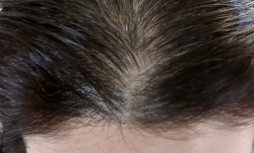 Image 3: Lip, Eyeliner & Brow Tattoos or Scalp Micro Pigmentation Sessions