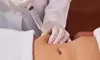 Achieve Your Desired Shape with Body Sculpting Session at Fernanda Body Aesthetics ( Up to 43% Off )