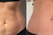 Lifestyle Health Solutions Offers 3D Styku Body Scanning and T-Shape 2 Sculpting Sessions (Up to 55% Off) - Second Medium