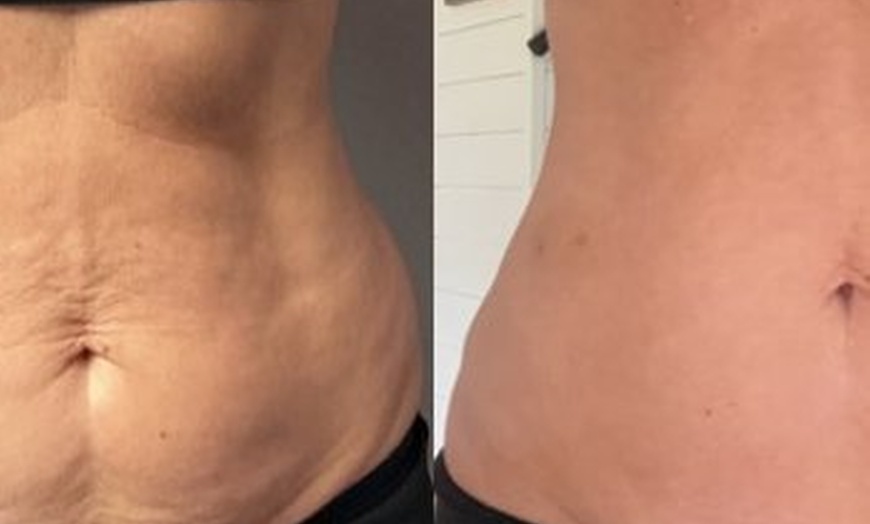 Image 7: Track Progress with 3D Body Scans and Body Sculpting Sessions