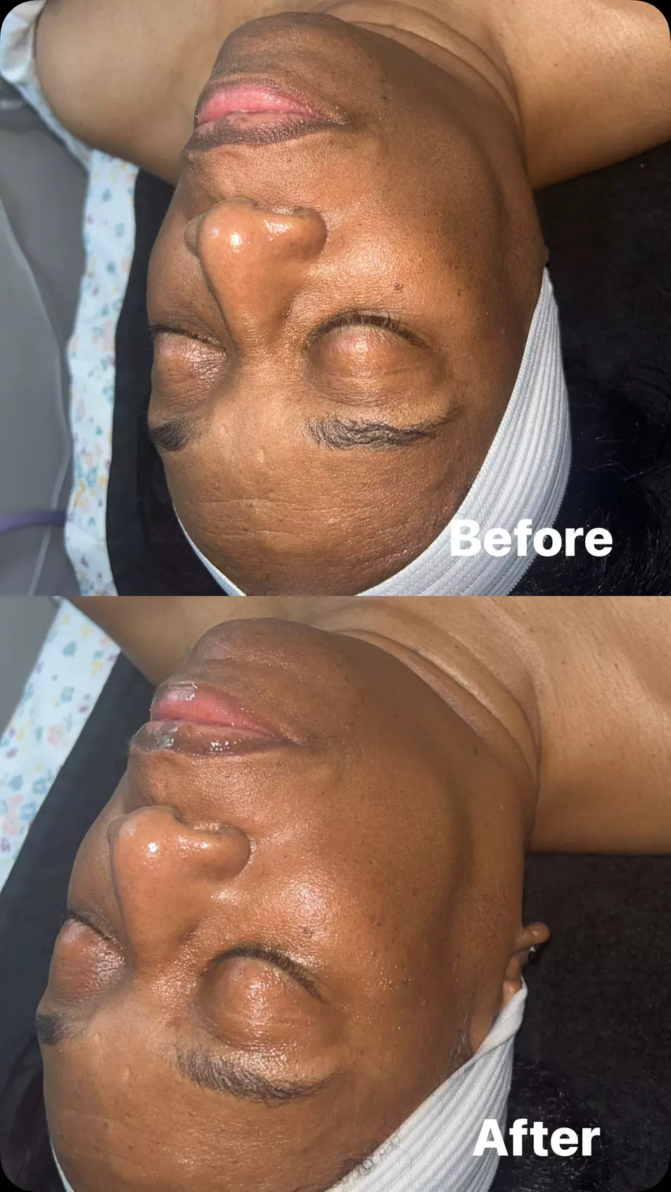 Get Smooth Skin with a Brazilian Wax