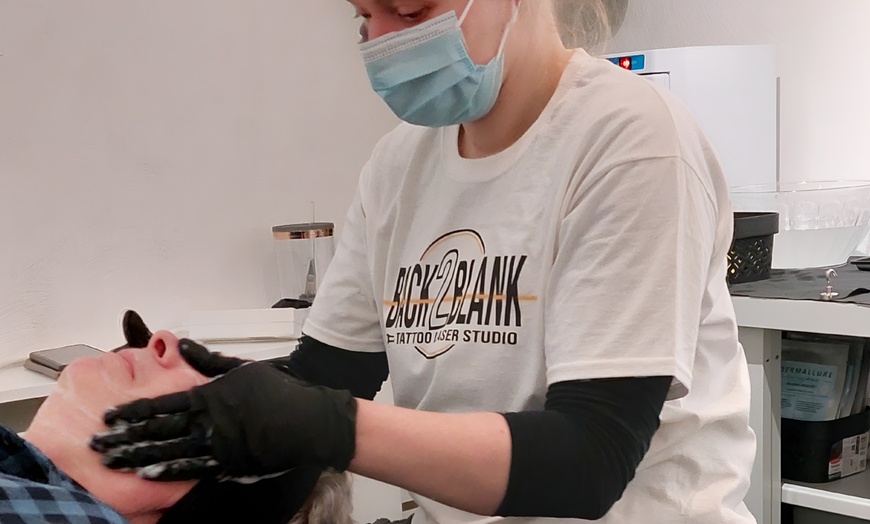 Image 10: Effectieve carbon laser peeling voor huidverjonging en collageenboost