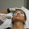 Image 4: Refresh Your Look with One or Two Sessions of Fotona 4D