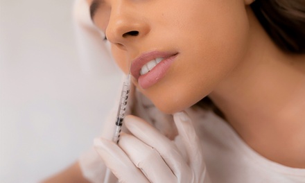 Lip Flip with Neurotoxin - Estetika Med Spa
