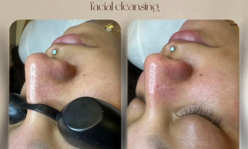 Image 7: Deep Cleansing Facial with Optional Choice of Add-on Treatments