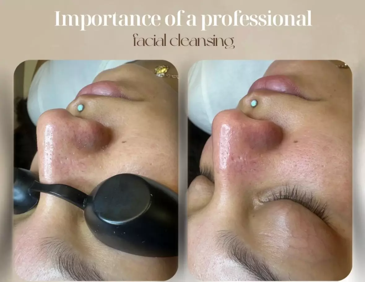 Deep Cleansing Facial with Optional Choice of Add-on Treatments