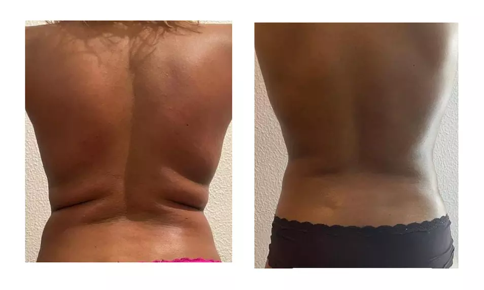 2 o 4 sesiones de maderoterapia corporal con drenaje linfático