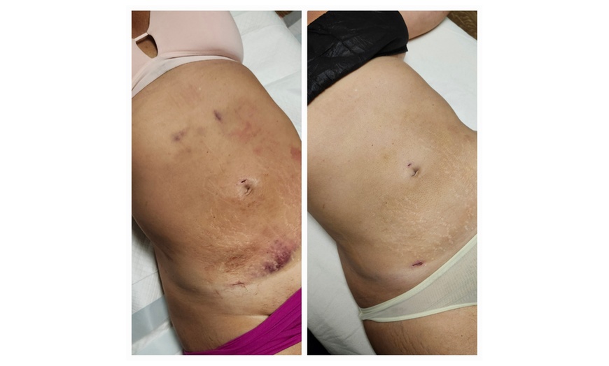 Image 5: Relax with Relaxation/Pre/Post Natal or Lymphatic Drainage Massage