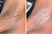 True Essence Spa: Brazilian, Stomach Strip, Underarms Waxing or a Combo Services (Up to 31% Off) - Second Medium