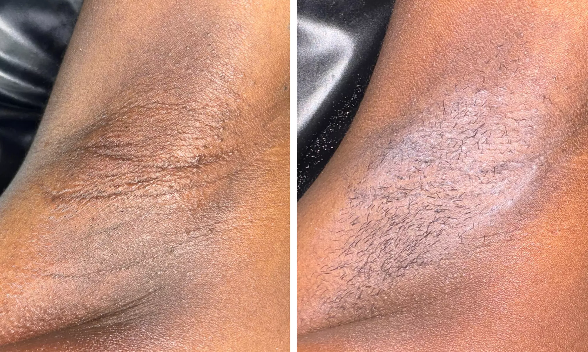 Complete Care: Brazilian, Stomach Strip, Underarms
