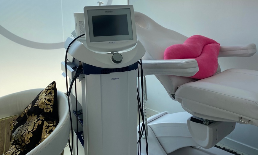 Image 7: Mesoterapia facial para hidratación profunda en 1, 2 o 3 zonas