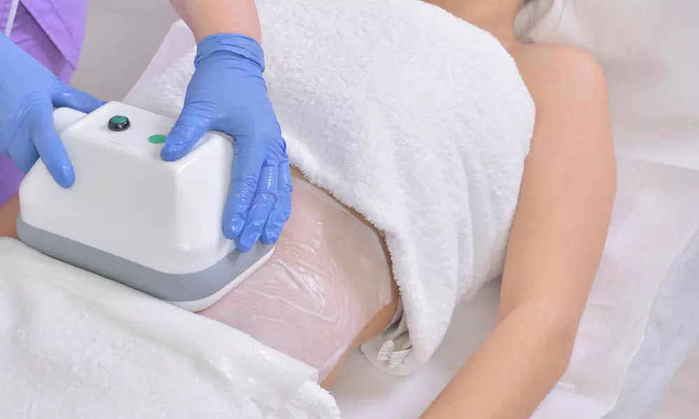 Cryolipolysis Fat Freezing at Miami Kiss