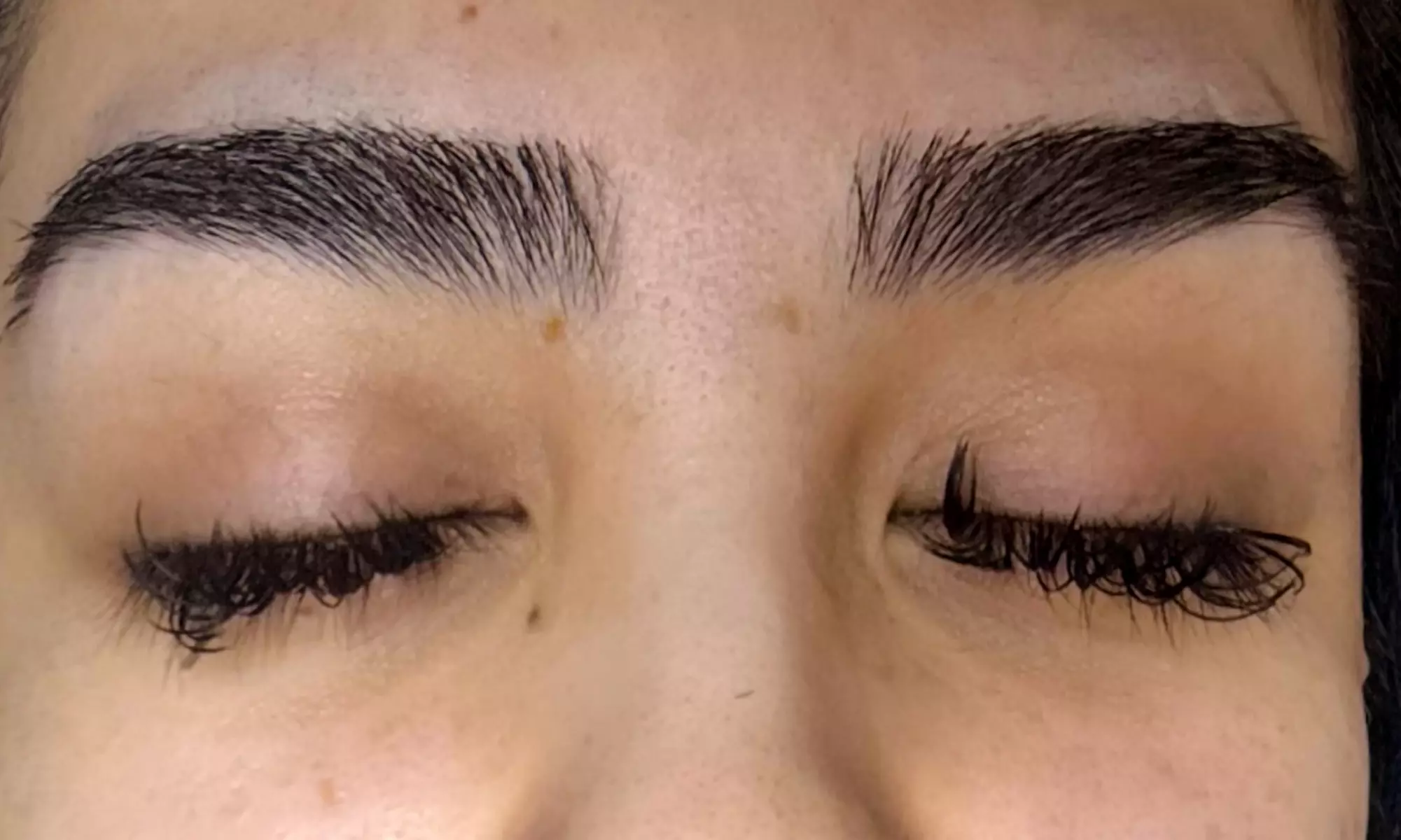 Facelift, Body Contouring & Lymphatic Massage for Total Renewal