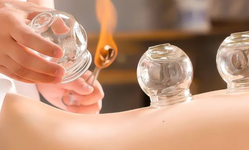 Image 1: Restore Energy Flow: 30-Minute Fire Cupping Session with Acupuncture 
