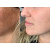 Image 4: Lumecca IPL Session for Full Face, Face and Neck or Face, Neck & Chest