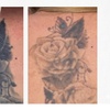 Image 4: Three Laser Tattoo Removal Sessions on an Area (1,3 or 6 Inches)