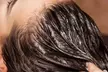 Japanese Head Spa, Ayurvedic Scalp Treatment & Hair Loss Consultation(Up to 45% Off)at L'Elite Hair Loss Experts - Second Medium