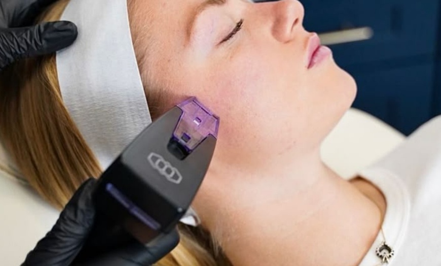 Image 2: Morpheus8 Non-surgical Tightening - Allure Passions Aesthetic Clinic