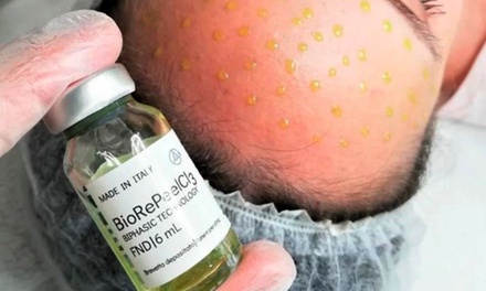 One BioRePeel treatment - Skin And Wax Co