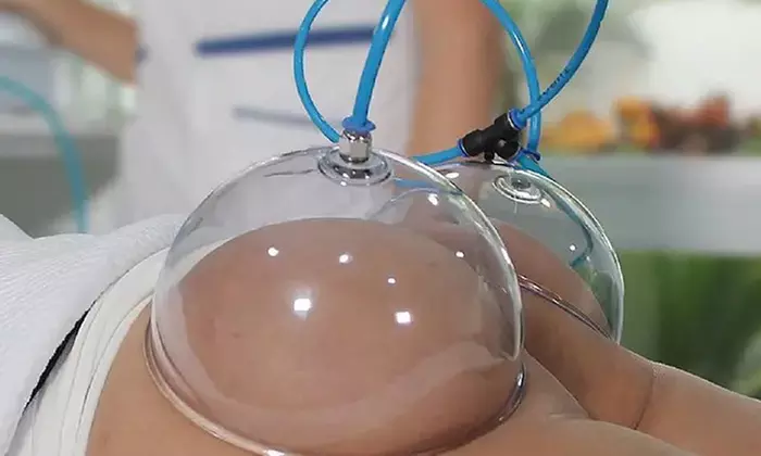 1 o 3 sesiones de levantamiento de glúteos con vacumterapia y maderoterapia en HIC Tratamientos de Belleza - Primary Image