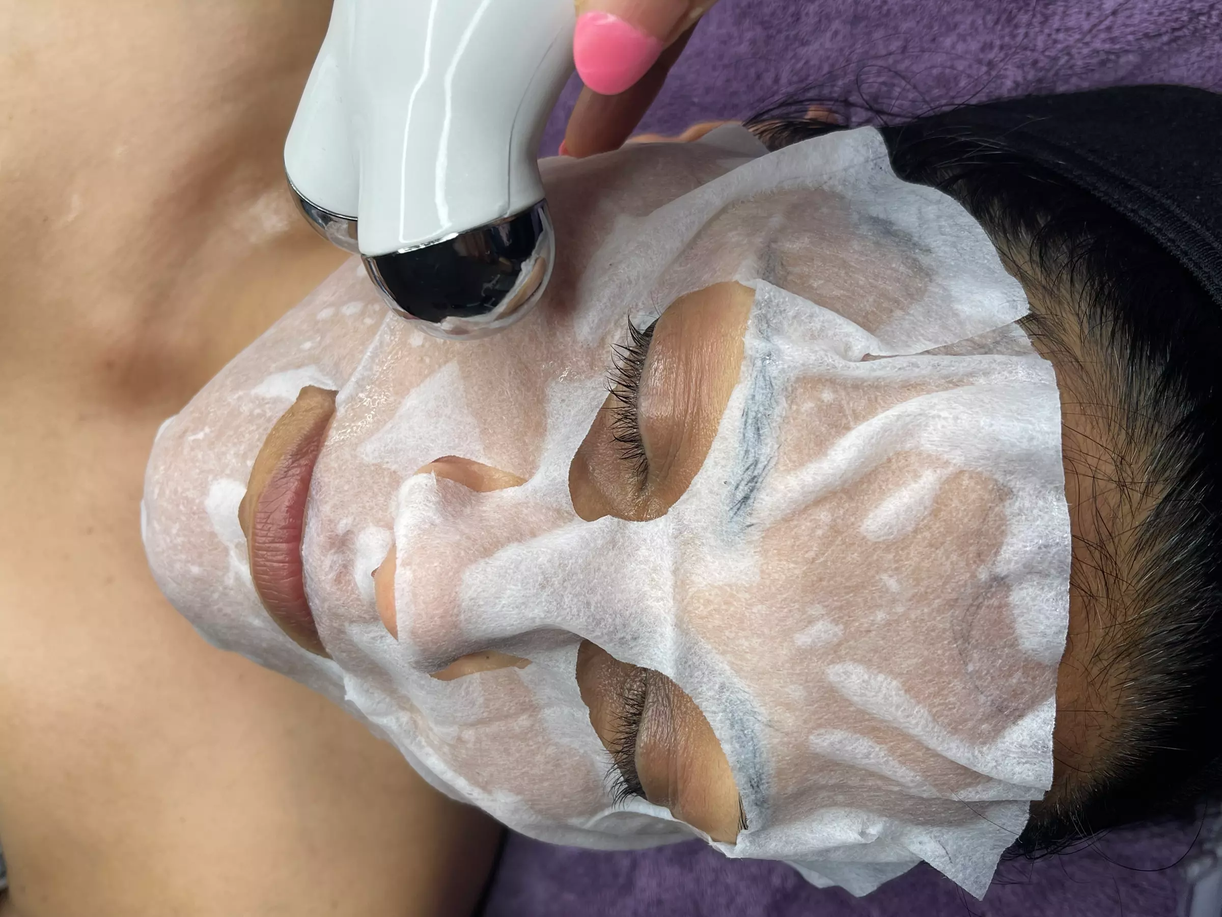 Enhance Facial Beauty with Carboxy Therapy for Face & Optional Neck!