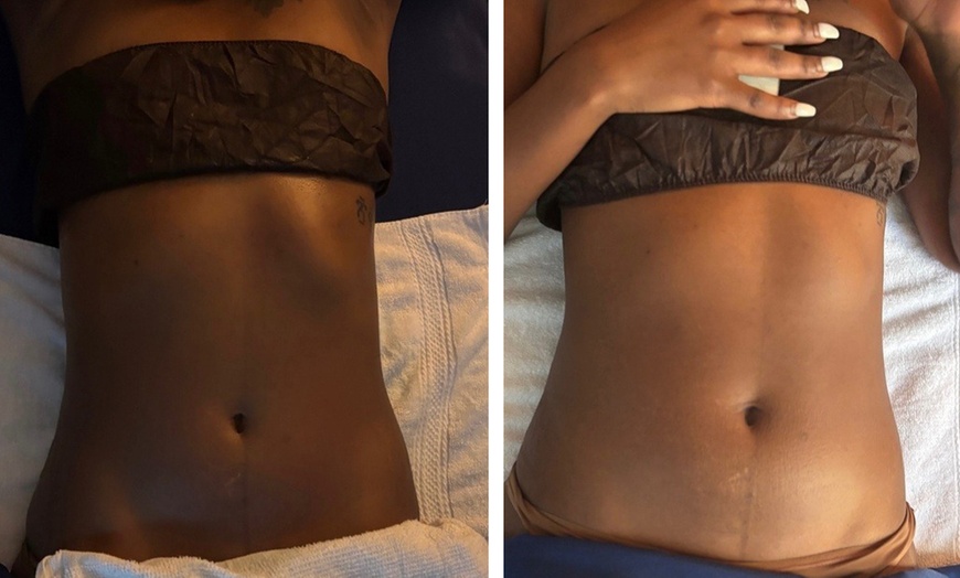 Image 5: Deluxe Lymphatic Drainage & Body Sculpt Sessions
