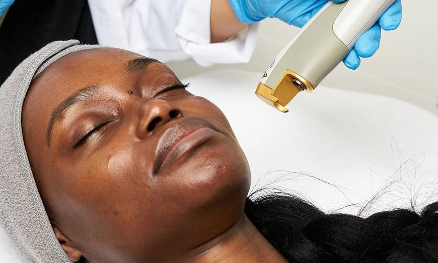 Image 2: Refresh Your Skin with Two or Three Laser Genesis Treatments