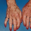 Image 3: Enhance Beauty with Deluxe Hand Rejuvenation! 