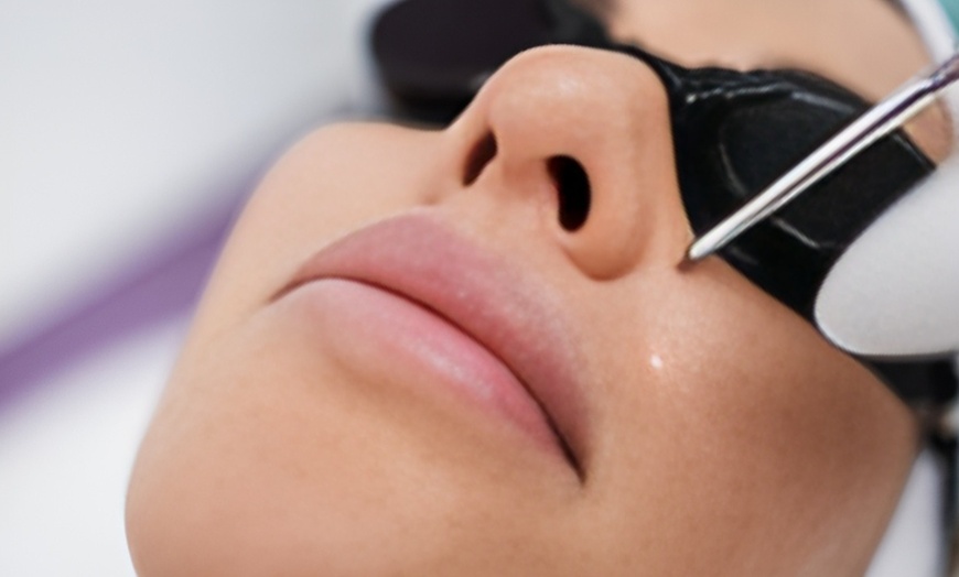 Image 1: Glad & stralend: 1, 3 of 5 anti-age laserbehandelingen