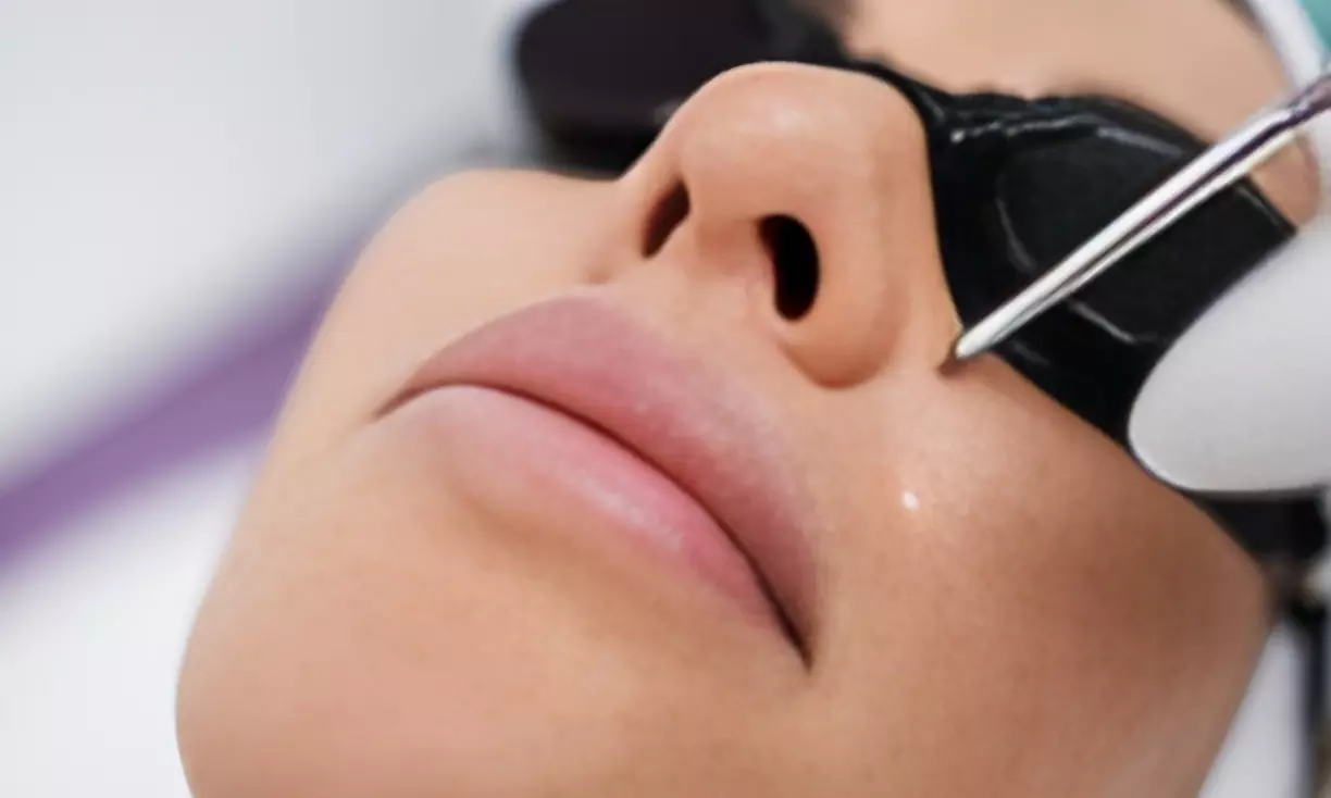 Glad & stralend: 1, 3 of 5 anti-age laserbehandelingen