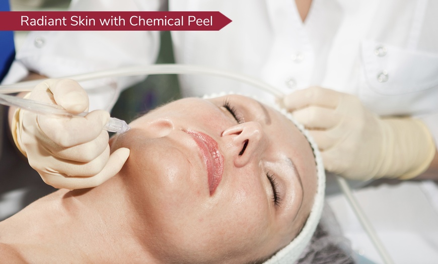 Image 1: Exfoliate and Glow with One or Two 30-Minute Chemical Peel Session