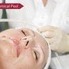 Image 1: Exfoliate and Glow with One or Two 30-Minute Chemical Peel Session