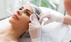 Revitalize with 20, 40, or 60 Units of Xeomin at UniqueU Aesthetics (Up to 37% Off)