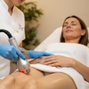 Image 2: Revitalize with One or Two Radio-Frequency Skin-Tightening Treatments