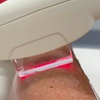 Image 2: Six Laser Hair Removal Sessions on One Small or Medium Area 