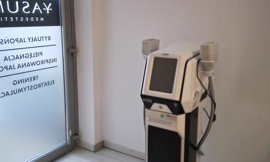 Image 6: KrioLipoliza Freeze Sculptor v2 – wymodeluj sylwetkę bez wysiłku