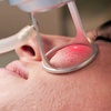 Image 1: Skin-Rejuvenating Fractional CO2 Laser Treatment for Wrinkles & Scars