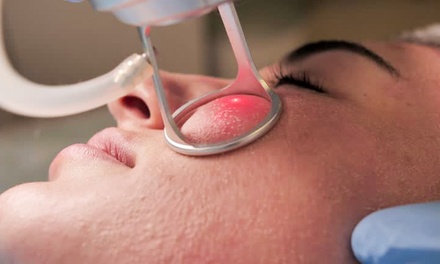 One CO2 Laser Skin Resurfacing Treatment for One Area - Time for You