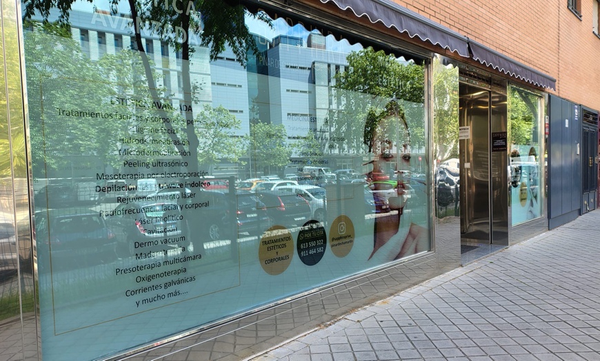 Image 7: Limpieza facial con opción a masaje, microdermoabrasión y vitaminas