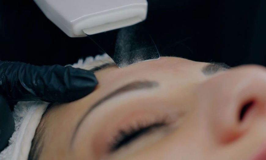 Image 2: Hydrogen-Gesichtsbehandlung/ Microneedling/ Microdermabrasion