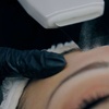 Image 2: Hydrogen-Gesichtsbehandlung/ Microneedling/ Microdermabrasion
