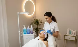 Tratamiento facial con hidrolimpieza, limpieza con dermapen, hidratación de labios o hilos de colágeno, al 84%