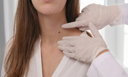 Removal of 1 Skin Tag, Age Spot, Wart, or Milia (up to 2mm) - Eliot Beauty