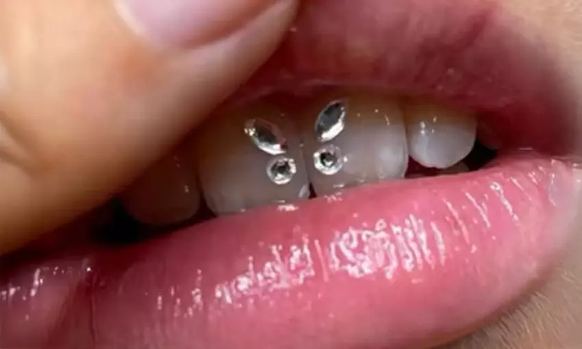 Zahnschmuck mit Swarovski®-Kristallen, Lash- oder Brow-Lifting + Farbe